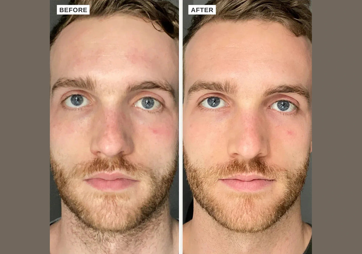 ALPHA-H | Vitamin B Serum