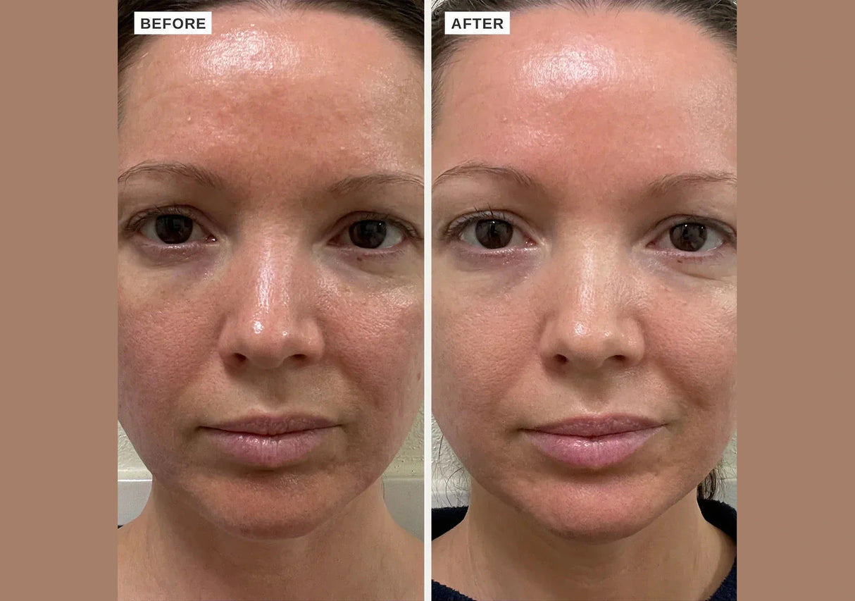 ALPHA-H | Vitamin B Serum