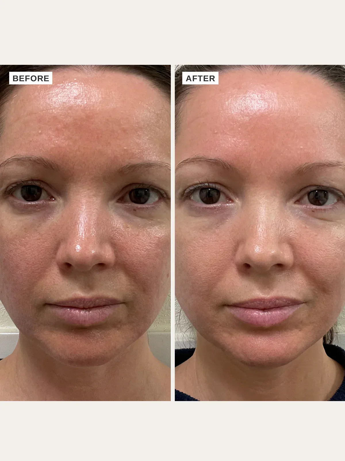 ALPHA-H | Vitamin B Serum - InternationalCosmetic