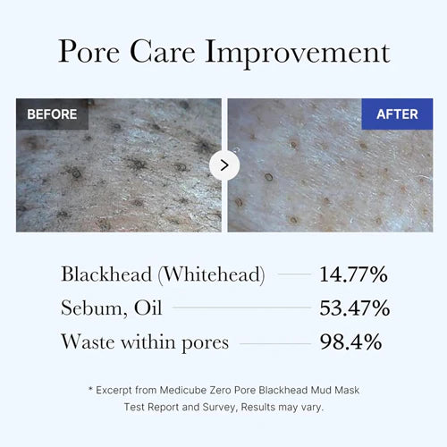 ZERO PORE MASQUE BOUESSEUX ANTI-POINTS NOIRS