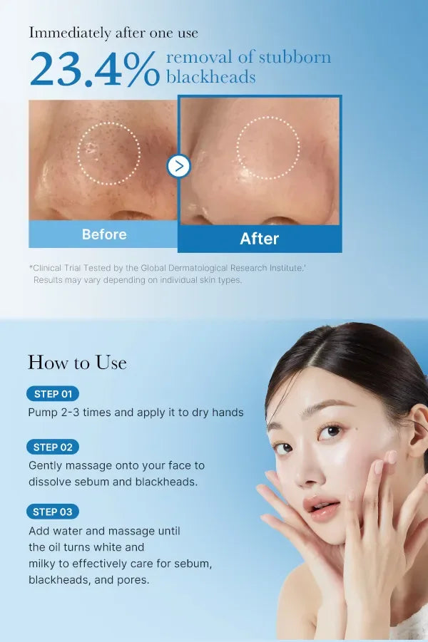 MEDICUBE | Zero Pore Blackhead Deep Cleansing Oil - 205 ml - InternationalCosmetic