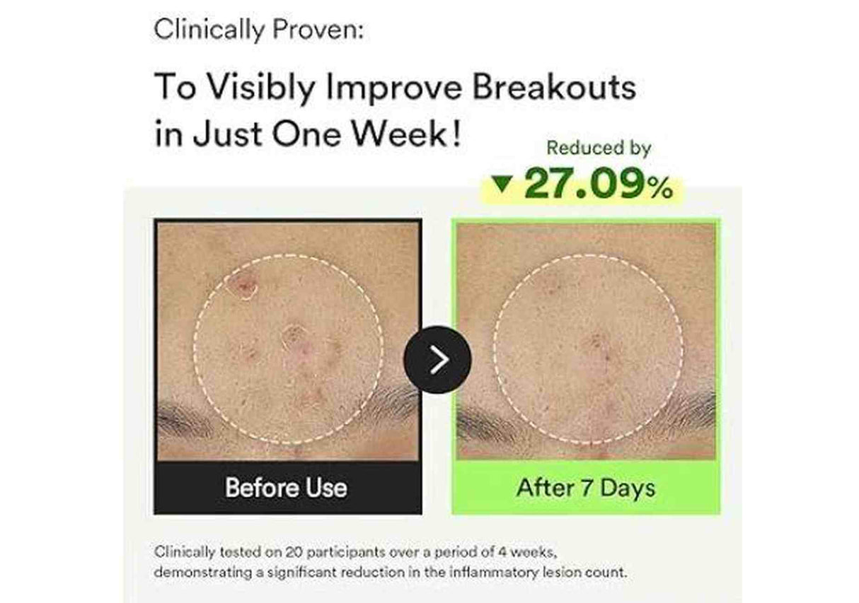 ABIB | Heartleaf TECA Capsule Serum - 50ml