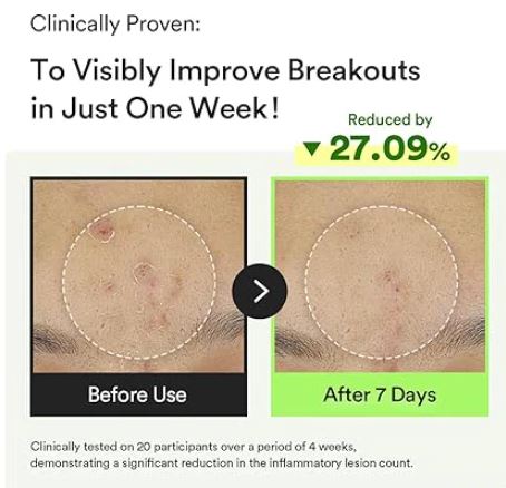 ABIB | Heartleaf TECA Capsule Serum - 50ml - InternationalCosmetic