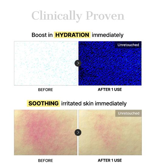 Advanced Snail Mucin Glass Glow Hydrogel Mask - 1 unit