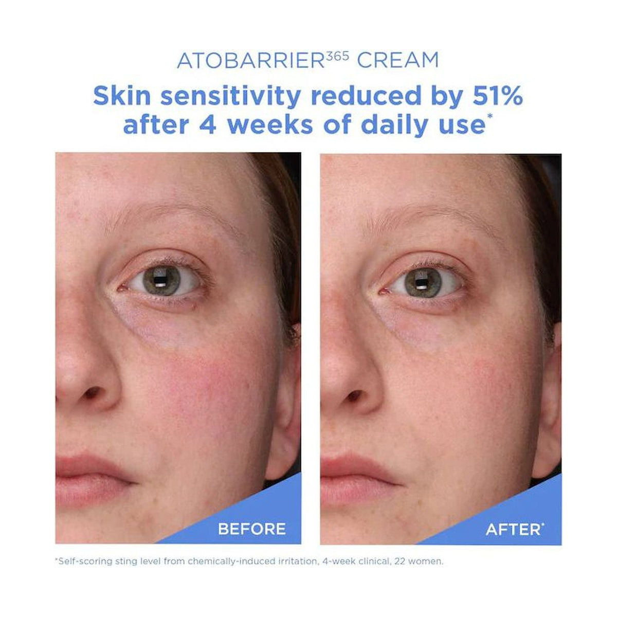 AESTURA Atobarrier 365 Cream Mini - 30ml: resultados cosméticos y evaluación de uso, detalle complementario; hidratación y barrera cutánea