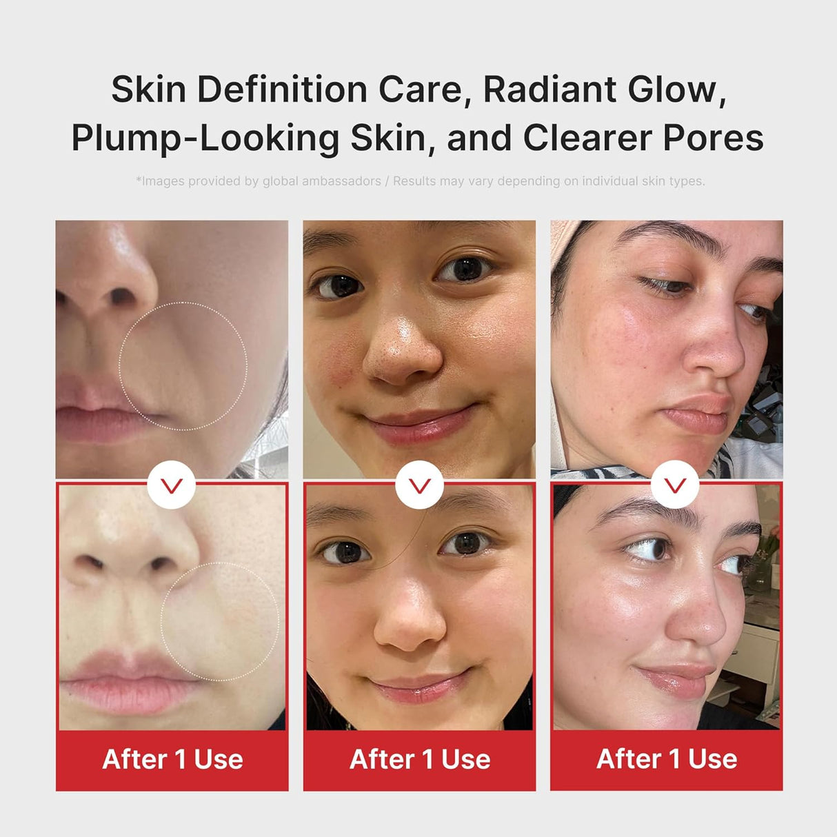 MEDICUBE | AGE- R Booster Pro - Pink