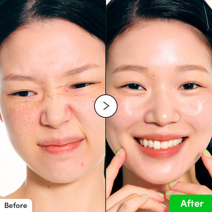 EQQUALBERRY | Aloe PDRN Calming Serum 30ml