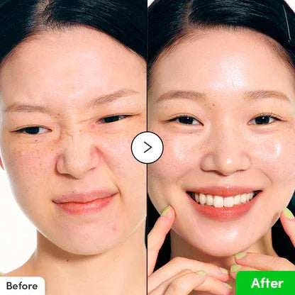 EQQUALBERRY | Aloe PDRN Calming Serum 30ml - InternationalCosmetic