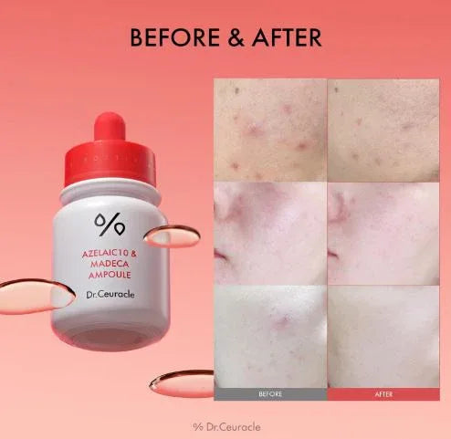 DR. CEURACLE | Azelaic 10 & Madeca Ampoule - 30ml - InternationalCosmetic