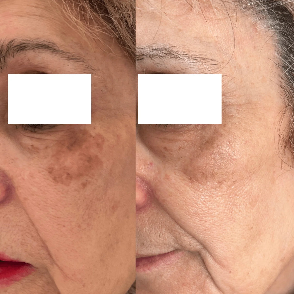 SEGLE | Clear Skin Pack Despigmentante - 60ml