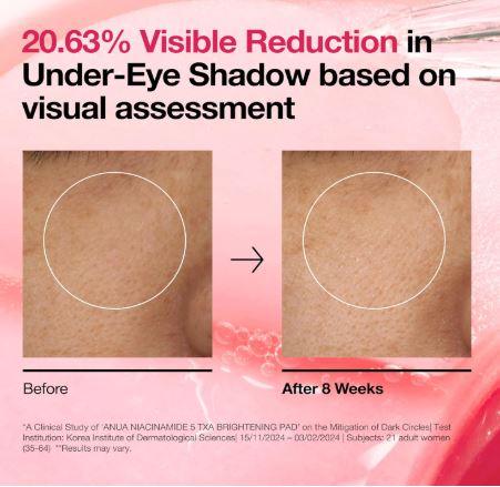 ANUA | Niacinamide 5 TXA Brightening Pads - 60ud - InternationalCosmetic