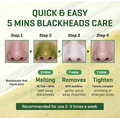 SOME BY MI | Bye Bye Blackhead 30 Days Miracle Green Tea Tox Bubble Cleanser - 120ml