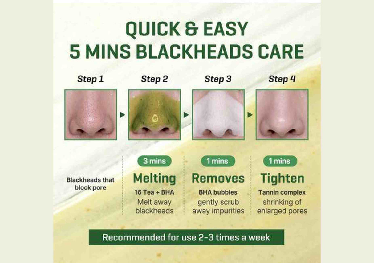 SOME BY MI | Bye Bye Blackhead 30 Days Miracle Green Tea Tox Bubble Cleanser - 120ml