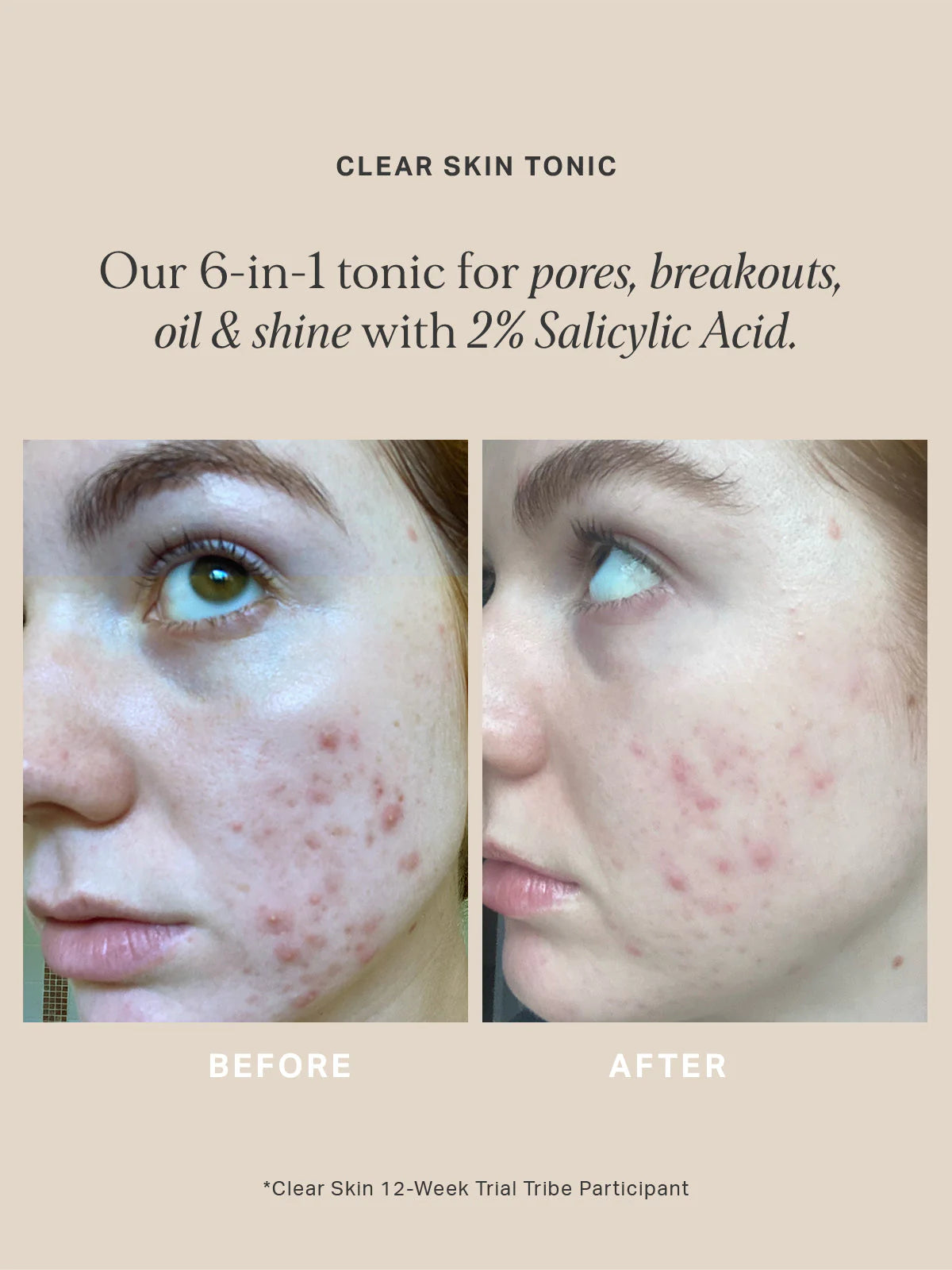 ALPHA-H | Clear Skin Tonic