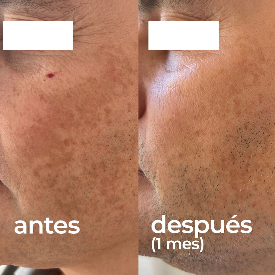 SEGLE | Clear Skin Pack Despigmentante - 60ml