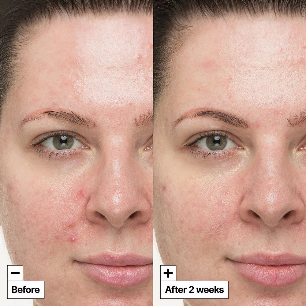 DR. JART | Cicapair So Soothing Treatment - 30ml