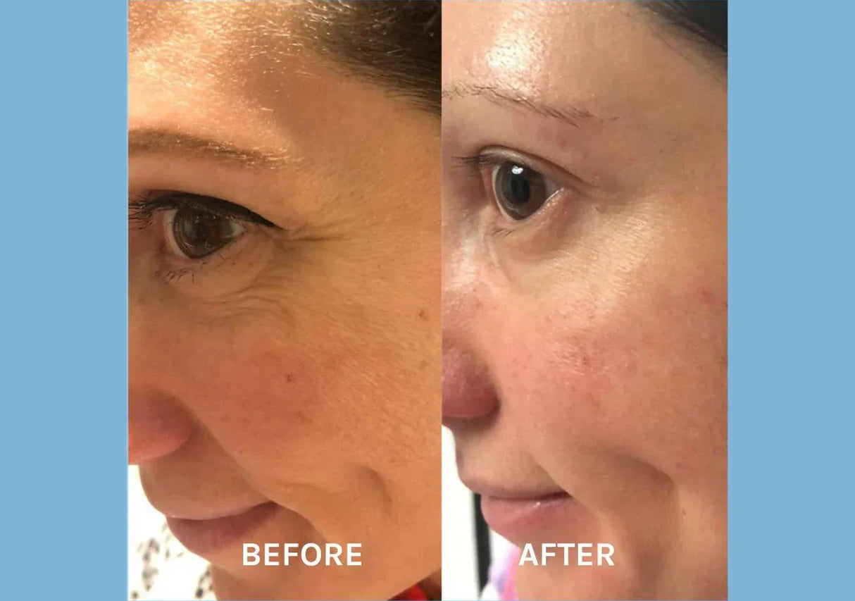 EVOLVE | Age Defying Lifting Serum - 30ml - InternationalCosmetic