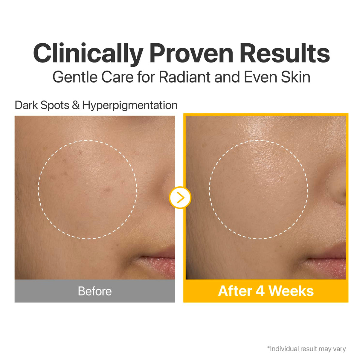 NUMBUZIN | No.5+ Glutathione Vitamin Concentrated Serum - 30ml - InternationalCosmetic