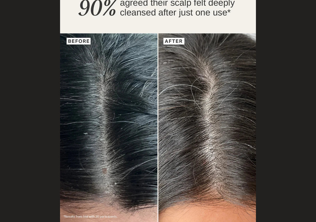 ALPHA-H | Healthy Scalp Exfoliating Treatment - 100ml