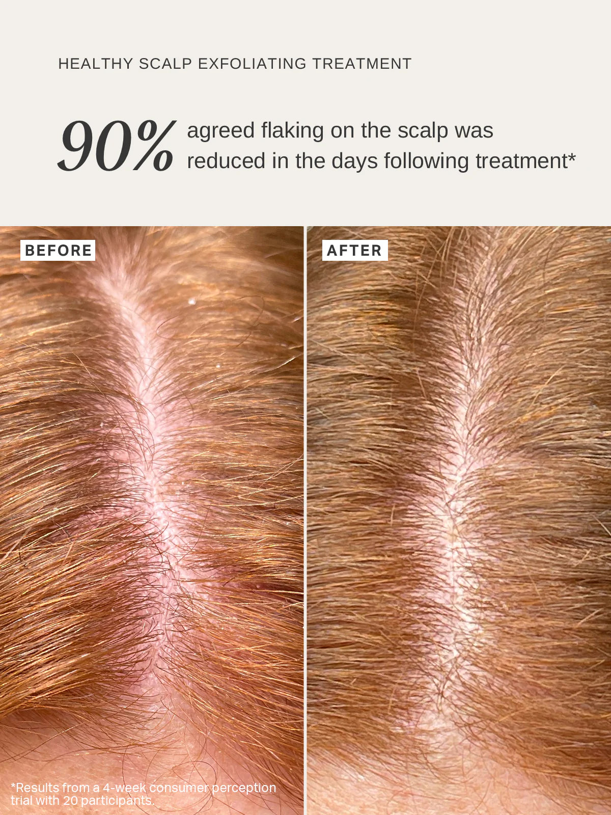 ALPHA-H | Healthy Scalp Exfoliating Treatment - 100ml