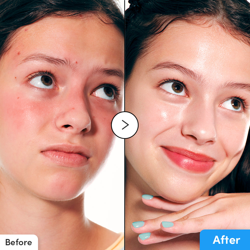 EQQUALBERRY | Hyaltoin Flooding Serum 30ml