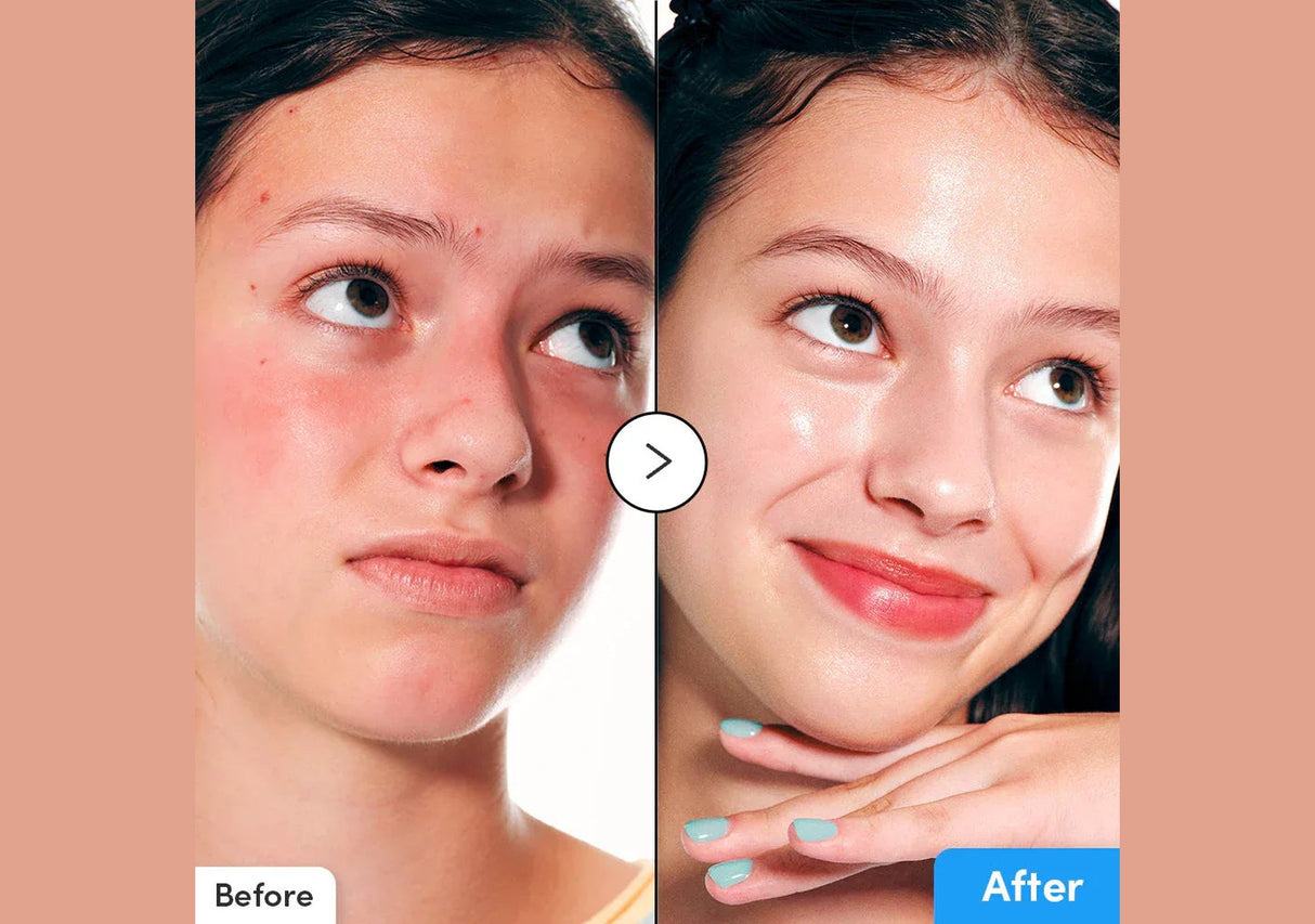 EQQUALBERRY | Hyaltoin Flooding Serum 30ml