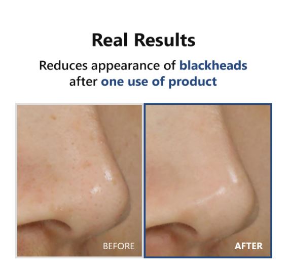 ISNTREE | Hyper Acid4 30 Serum AHA / BHA / PHA / LHA - 20ml