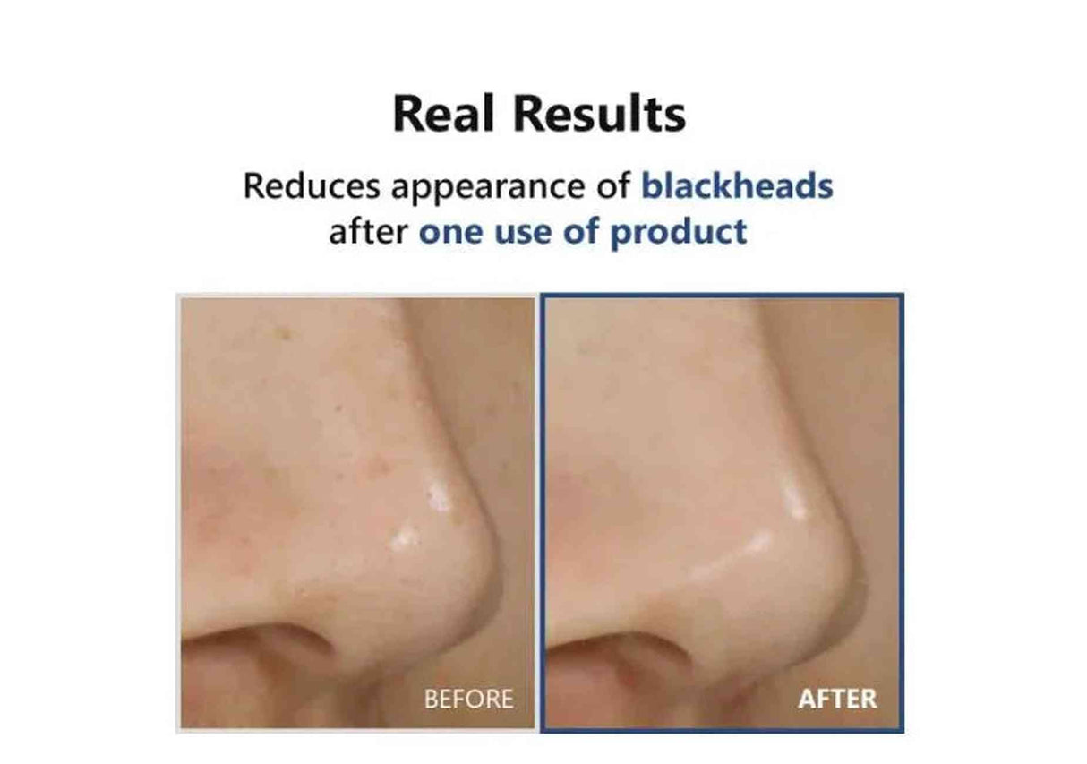 ISNTREE | Hyper Acid4 30 Serum AHA / BHA / PHA / LHA - 20ml