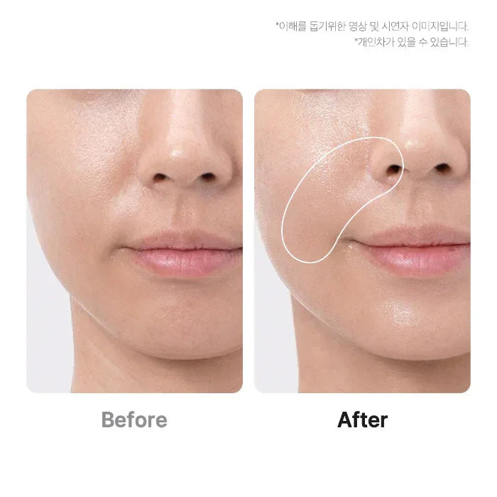 MEDICUBE | AGE- R Booster Pro - White