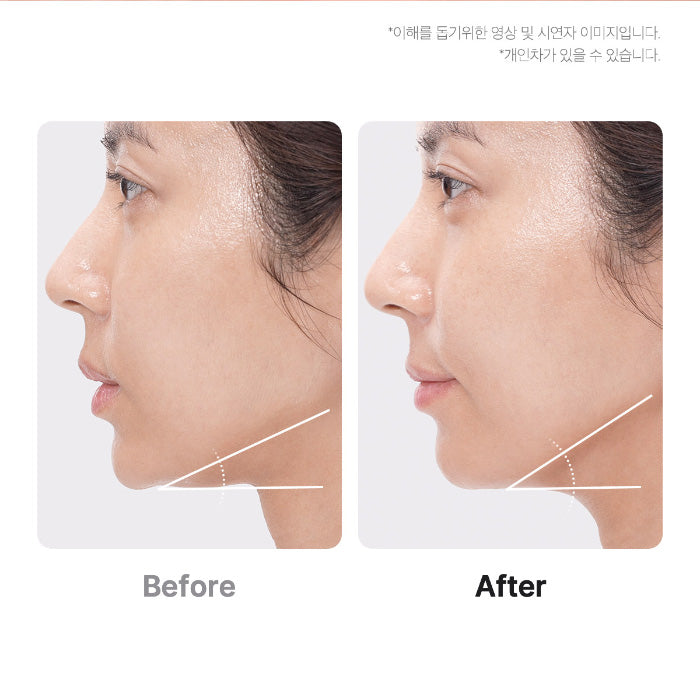 MEDICUBE | AGE - R Booster Pro - Negro