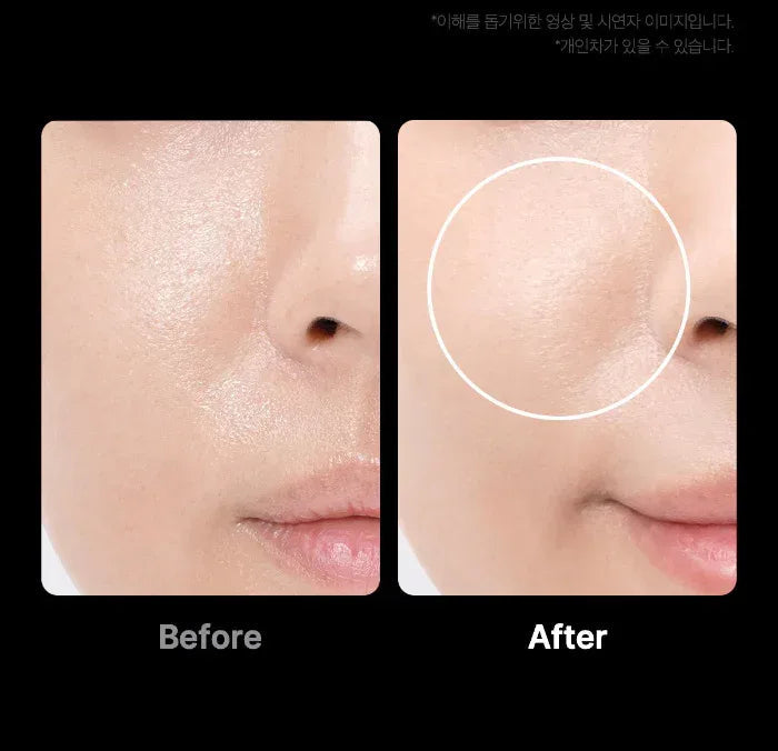 MEDICUBE | AGE- R Booster Pro - White