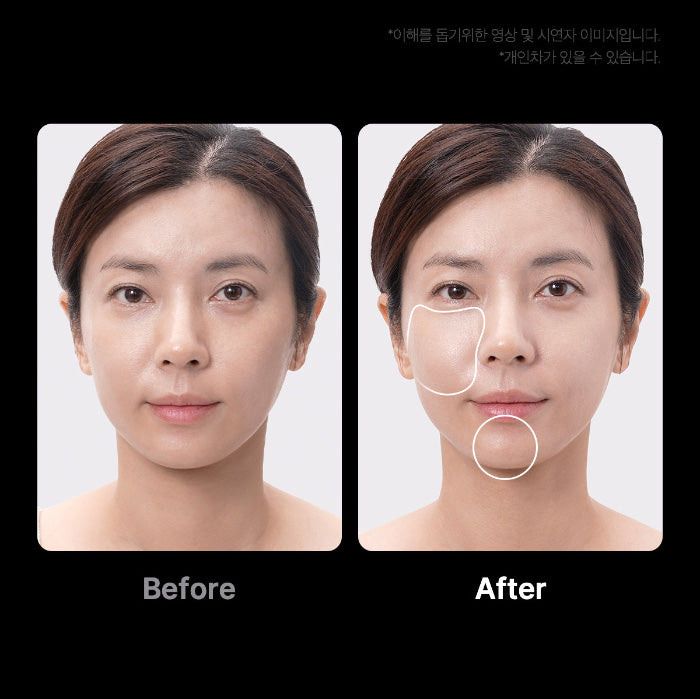 MEDICUBE | AGE - R Booster Pro - Negro