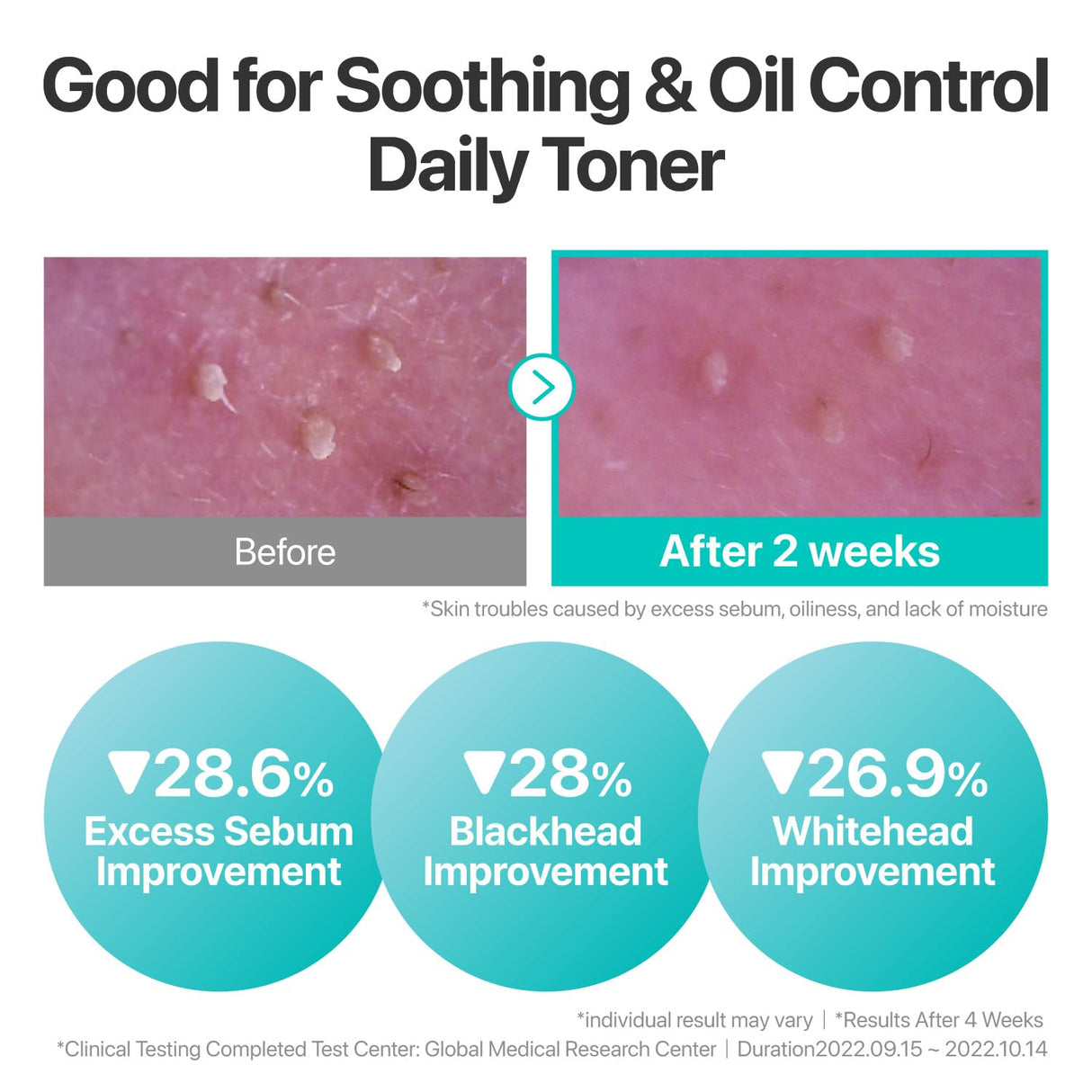 NUMBUZIN | No.1 Pure-Full Calming Herb Toner - 300ml