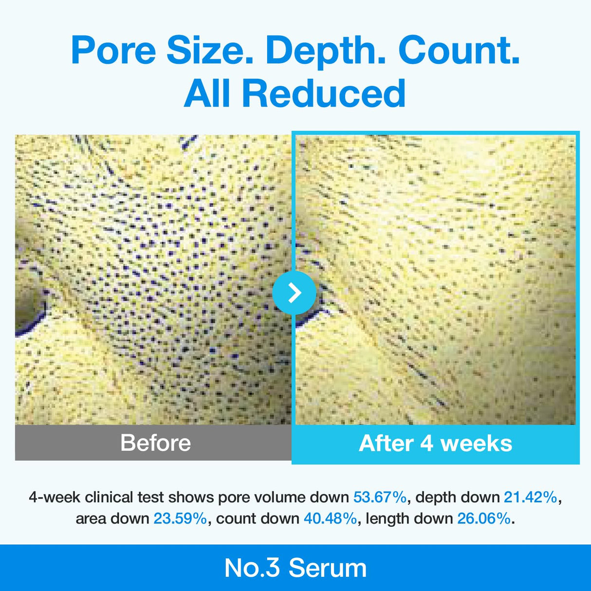 NUMBUZIN | No.3 Blue Bio-Retinol Pore Refining Serum - 30ml