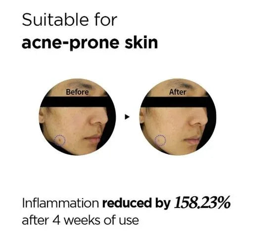 ISNTREE | Onion Newpair Spot Patch - InternationalCosmetic