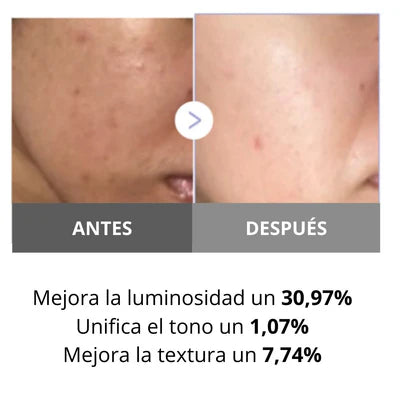 MEDICUBE | AGE-R Booster Pro Mini