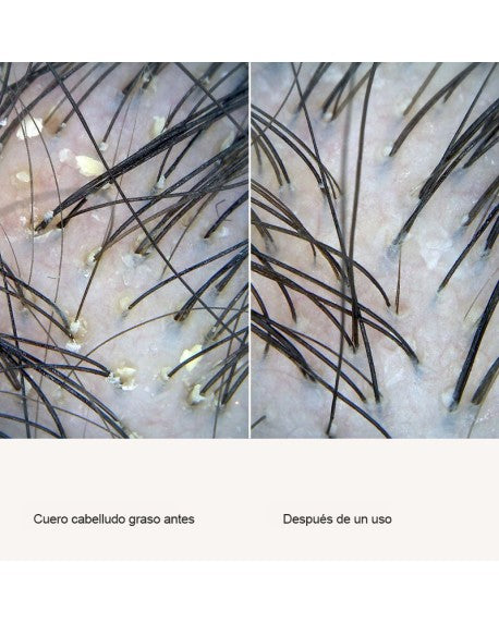 LIVING PROOF | Scalp Care Exfoliator - 100ml - InternationalCosmetic