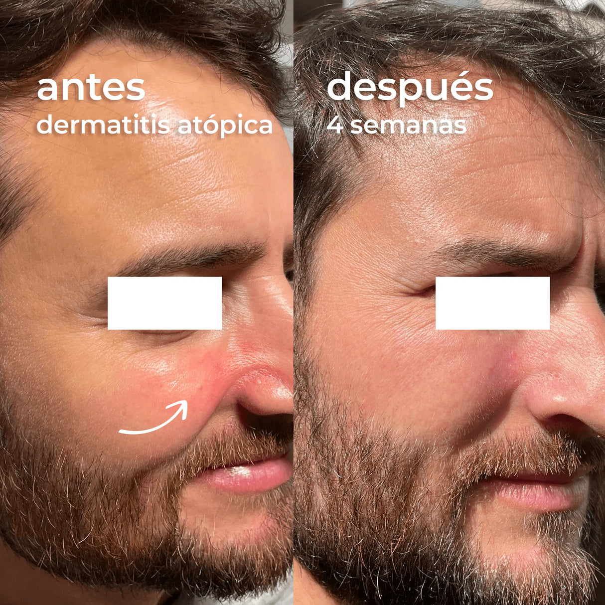 SEGLE | Skin Factor Barrier - Facial Cream Gel - 30ml