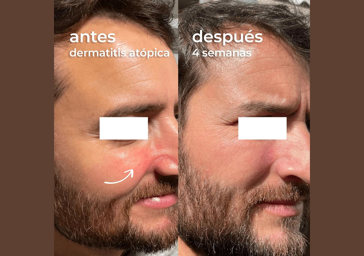 SEGLE | Skin Factor Barrier - Facial Cream Gel - 30ml