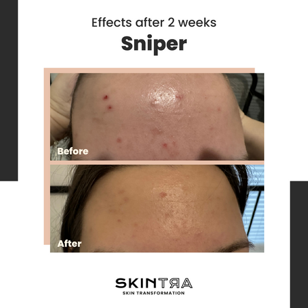 Skintra Sniper SOS Cream