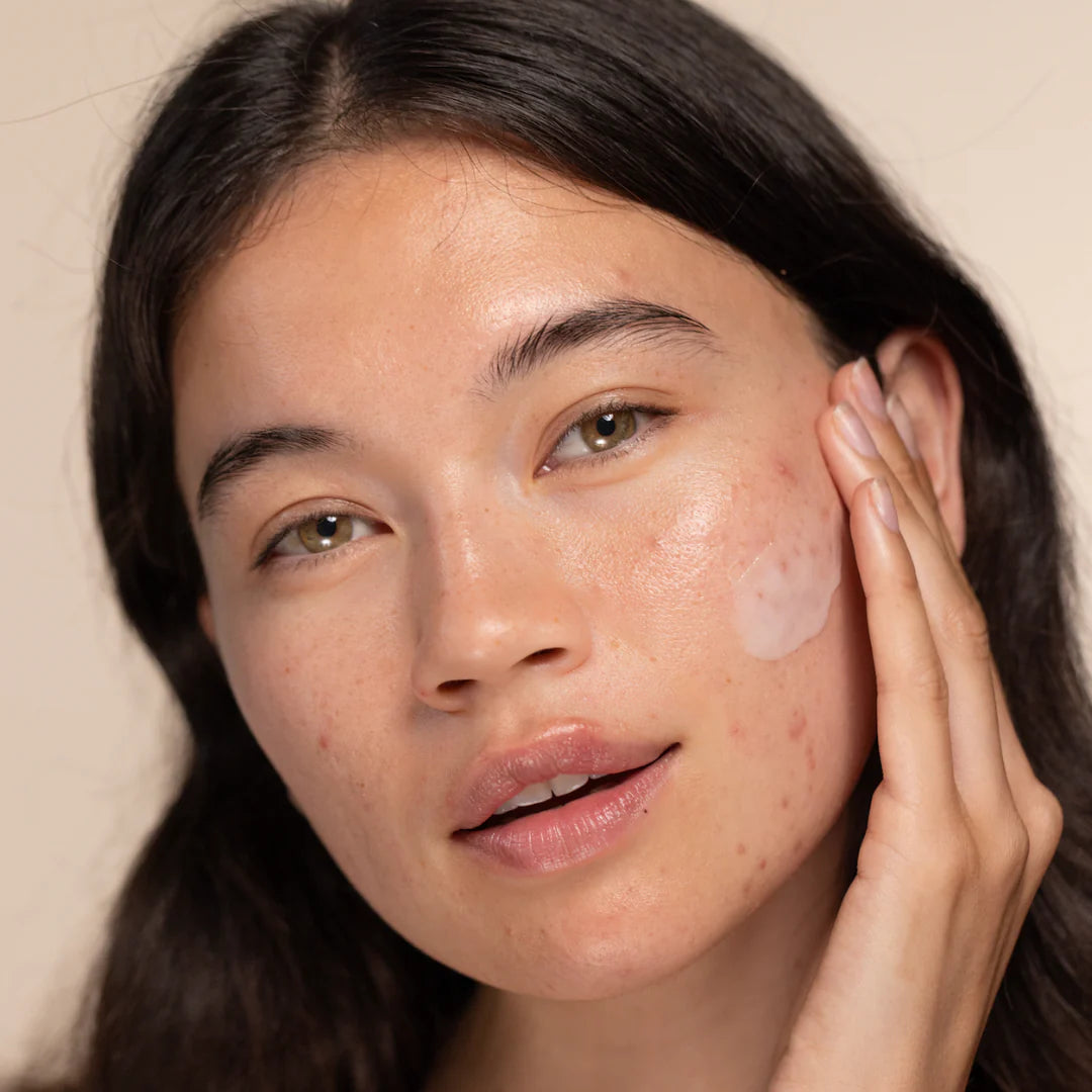 TWO POLES | Succinic Acid Salicylic Acid Blemish Control Treatment - 40ml