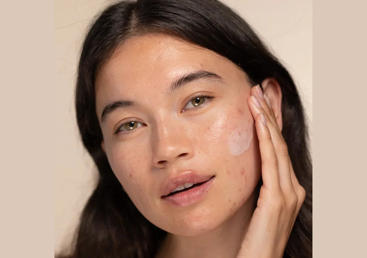 TWO POLES | Succinic Acid Salicylic Acid Blemish Control Treatment - 40ml - InternationalCosmetic