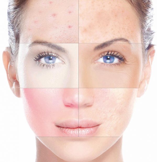 Análisis facial con IA ✨