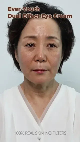 NINE LESS | Ever-Youth Dual Effect Eye Cream - 20 ml - InternationalCosmetic