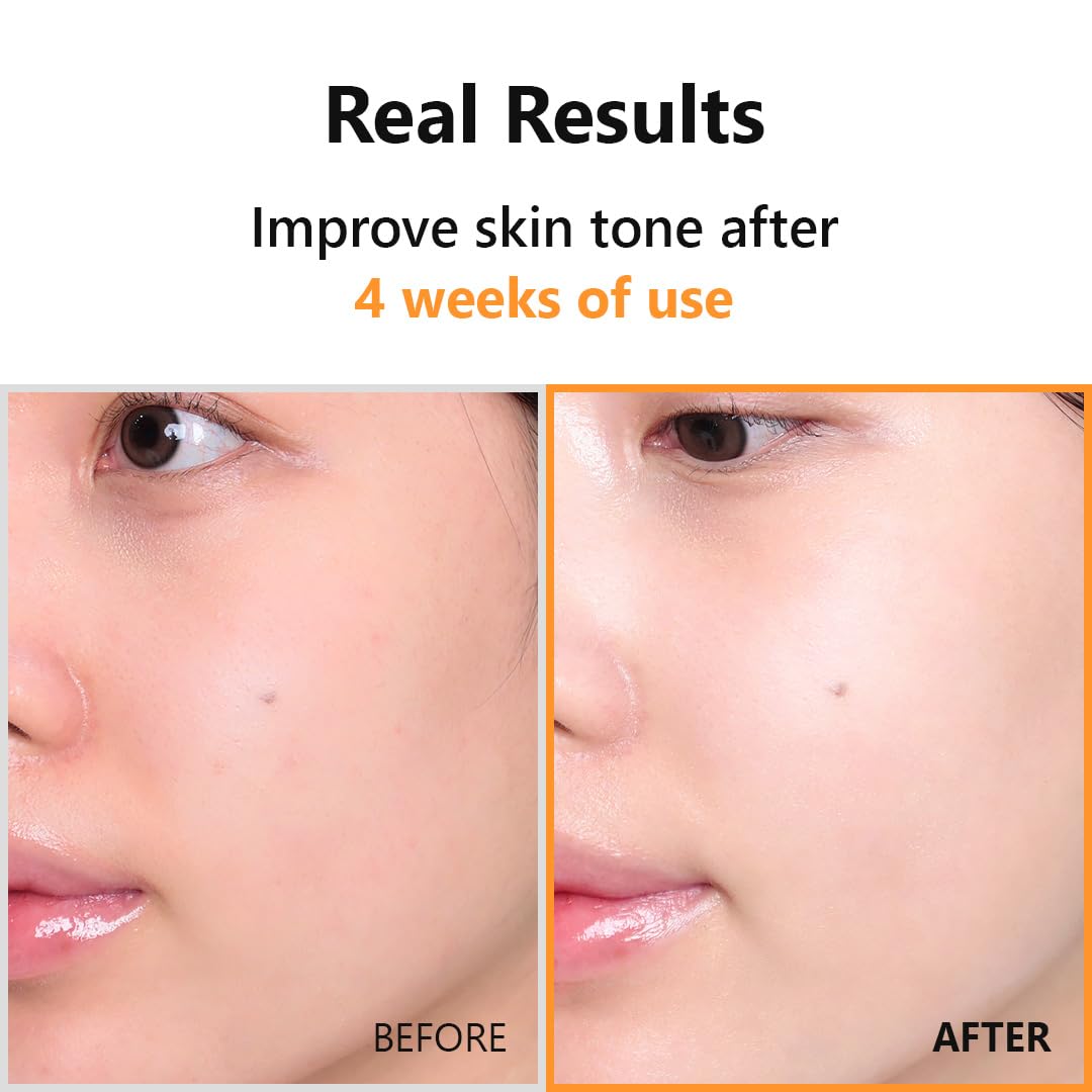 ISNTREE | Hyper Vitamin C 23 Serum - 20ml