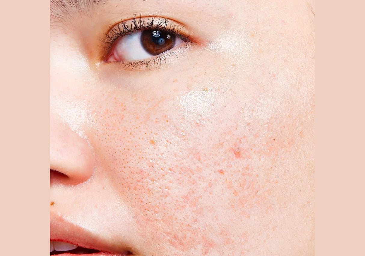 PSA | Gifted Acai & Sea Buckthorn Vitamin C Glow Oil - InternationalCosmetic