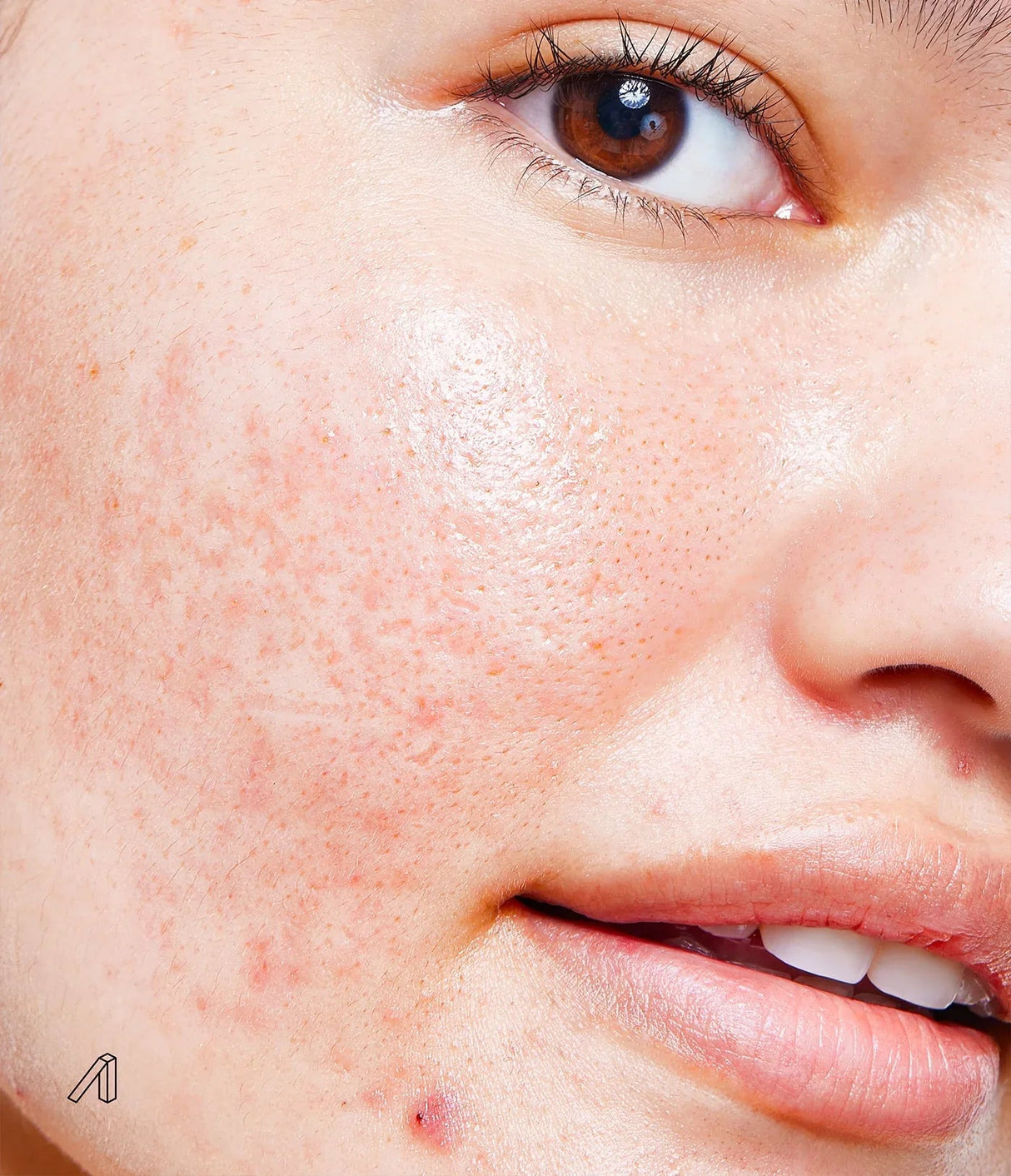 PSA | Liquid Panacea Centella & Kombucha Firming Recovery Booster - InternationalCosmetic