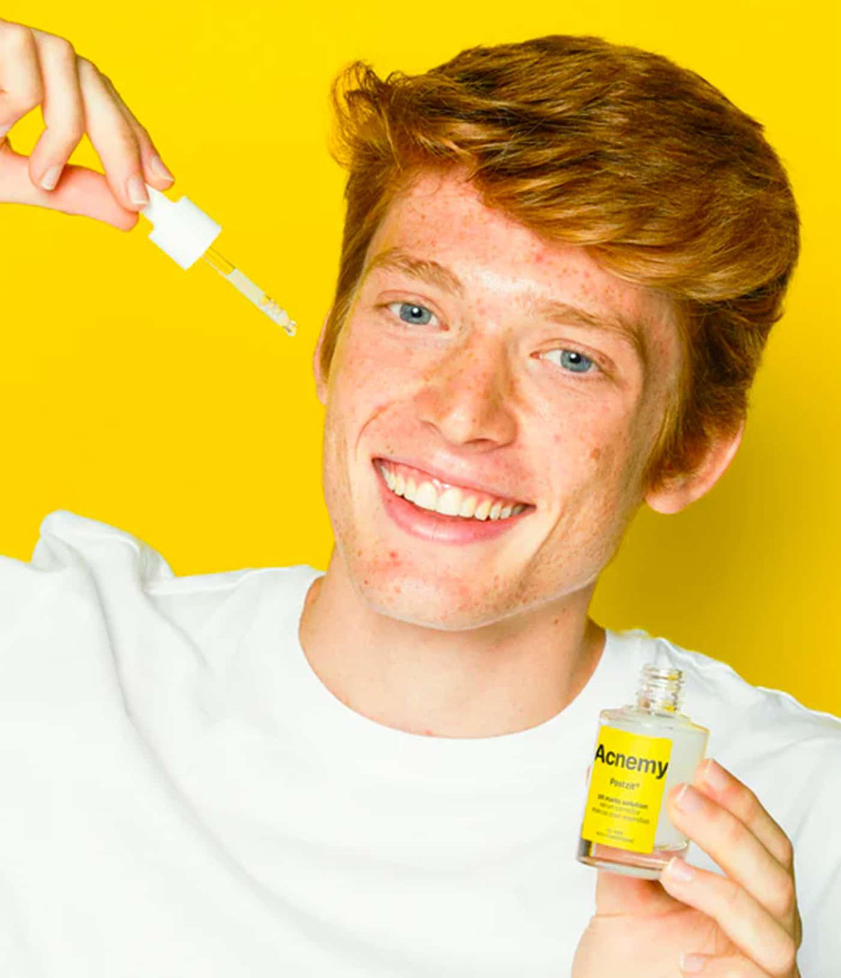 ACNEMY | Postzit® - 30ml - InternationalCosmetic