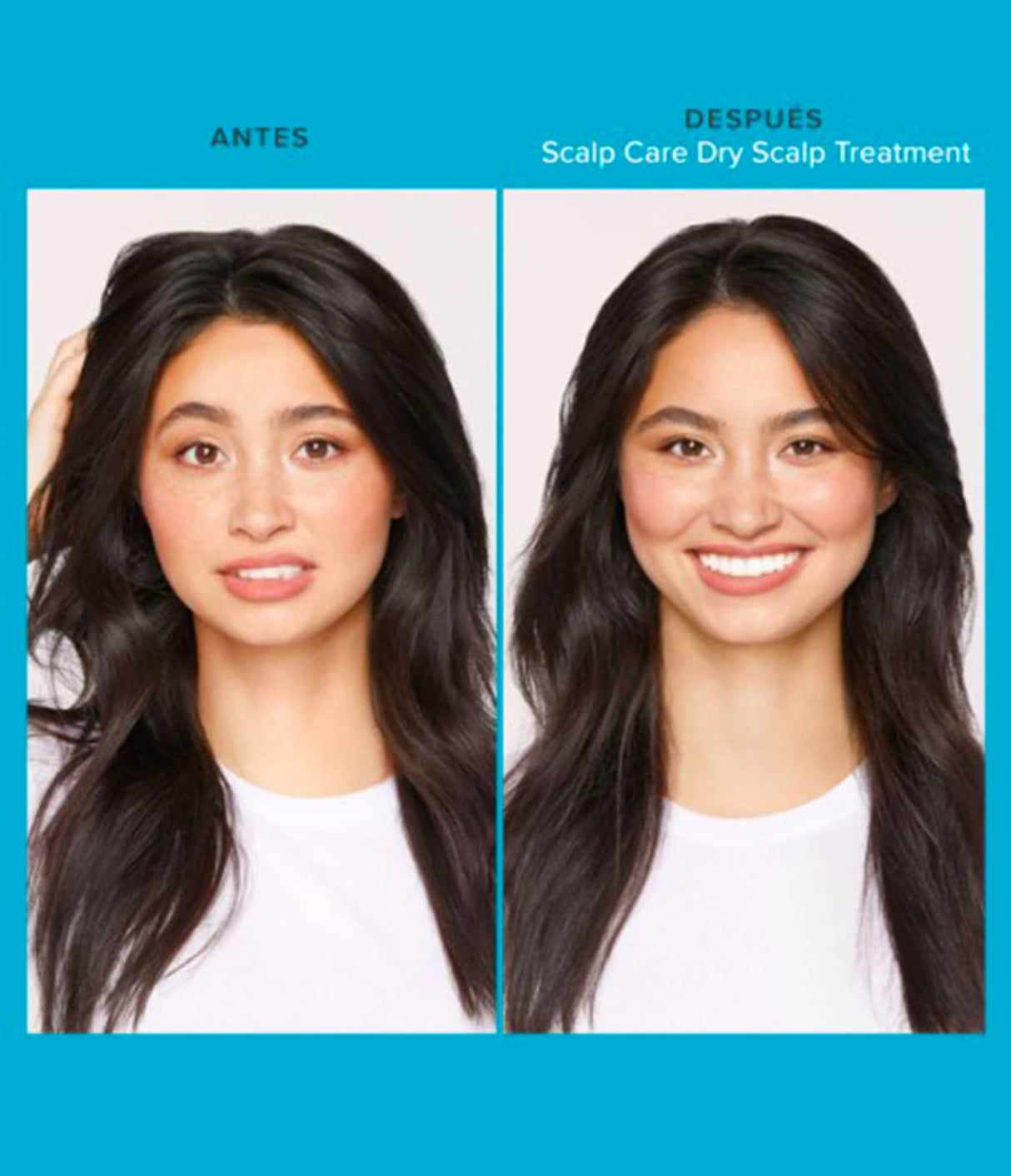 Scalp Care Dry Treatment de Living Proof