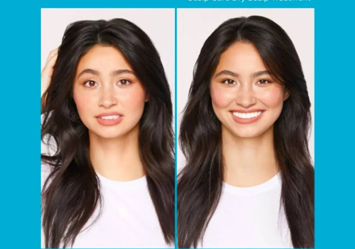 LIVING PROOF | Scalp Care Dry Treatment - 100ml